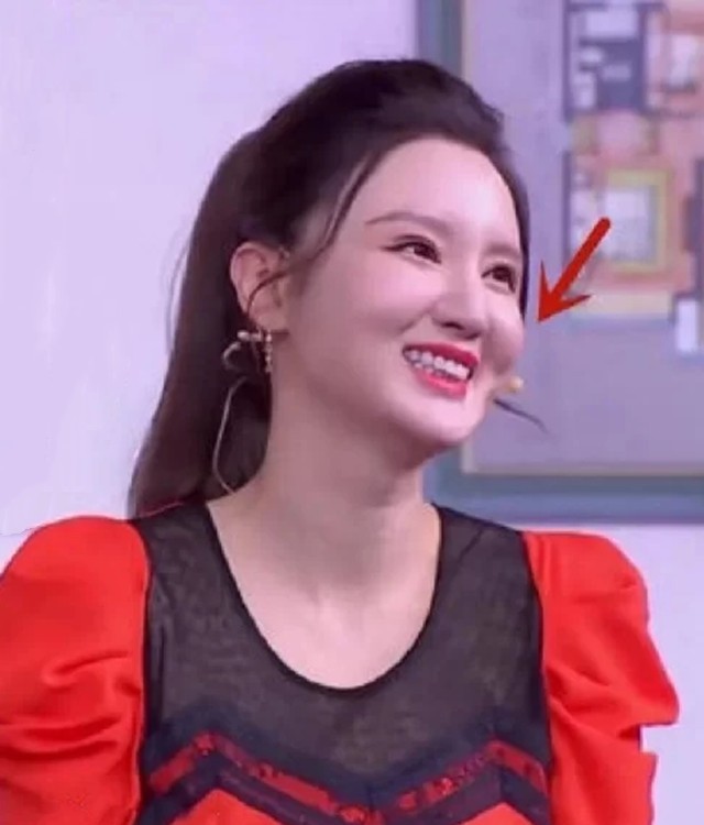 明星脸部僵硬的图片,很多明星脸僵是怎么回事