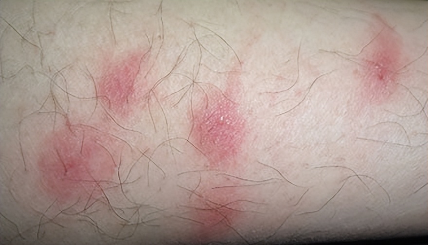 室内灭跳蚤的特效药,室内消灭跳蚤