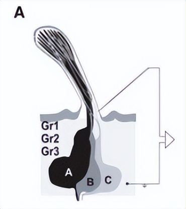 蚊子太烦人了晚上睡不着,总被蚊子吵醒还找不到蚊子是为啥