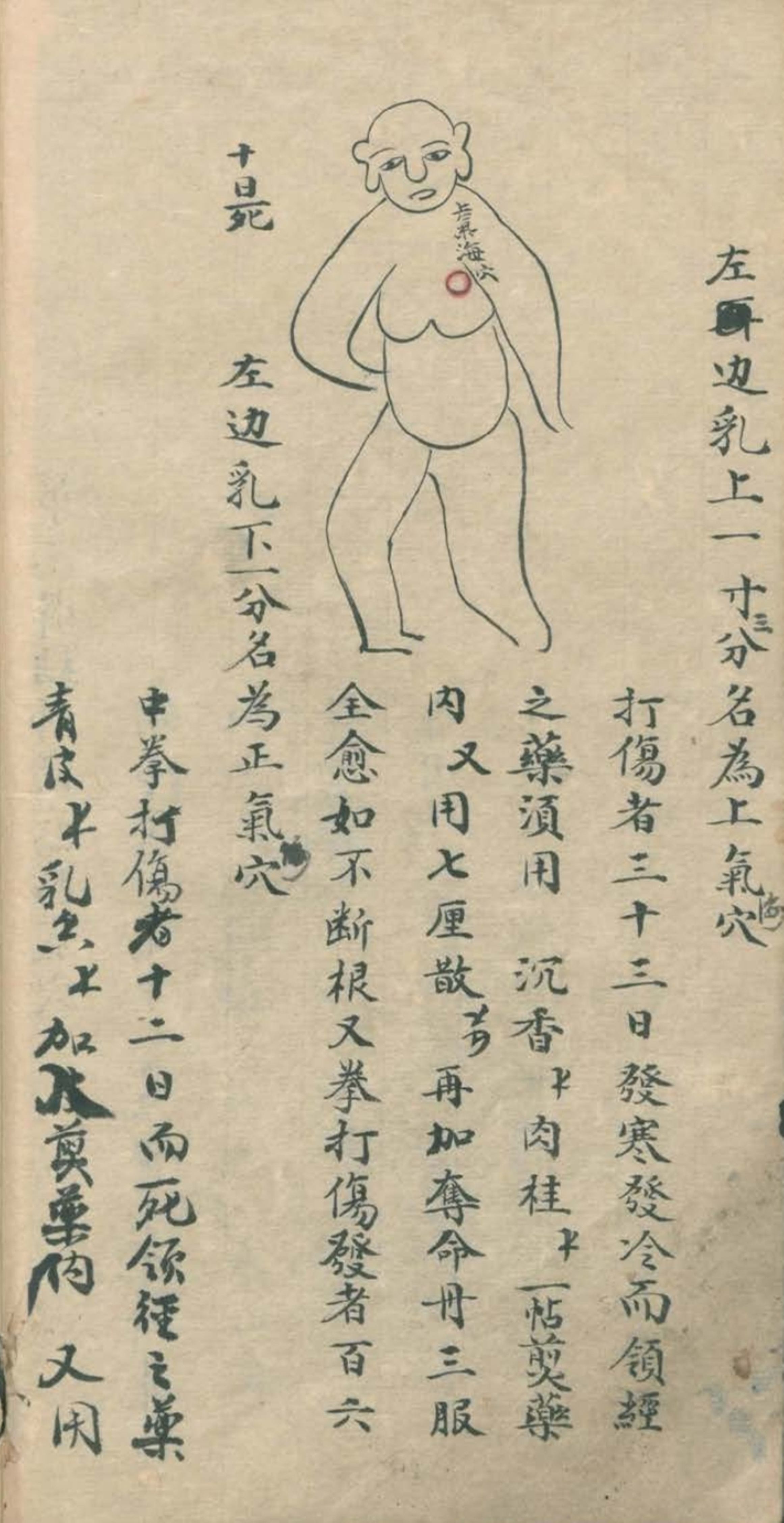 武当秘传跌打八法,民间中医古籍手抄本专医跌打秘方