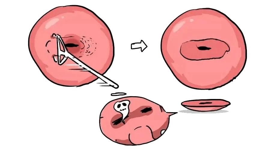 透明质酸凝胶能擦外阴瘙痒吗,外阴瘙痒有异味可以用什么药擦