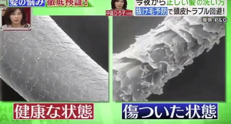 皮肤科医生头发怎么护理,医生吹头发用冷风还是热风更好