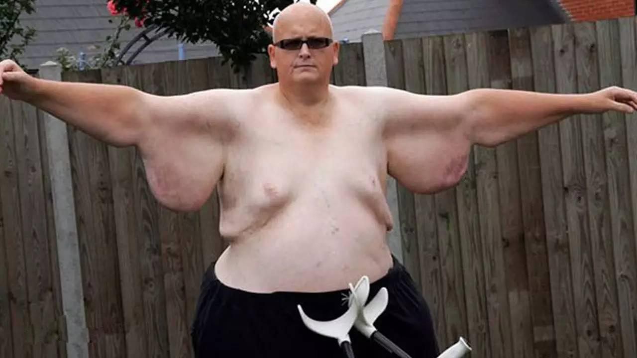 英国男子身高185体重只有120斤,英国男人体重600斤