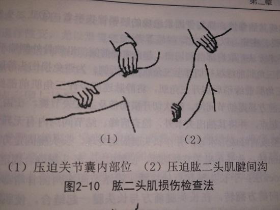 肱二头肌长头肌腱损伤能评伤残吗,肱二头肌长头损伤症状