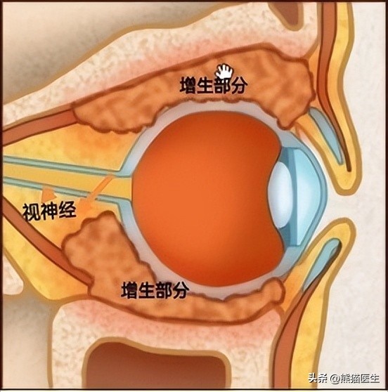 16年间增长20倍，这一部位病变累及全身