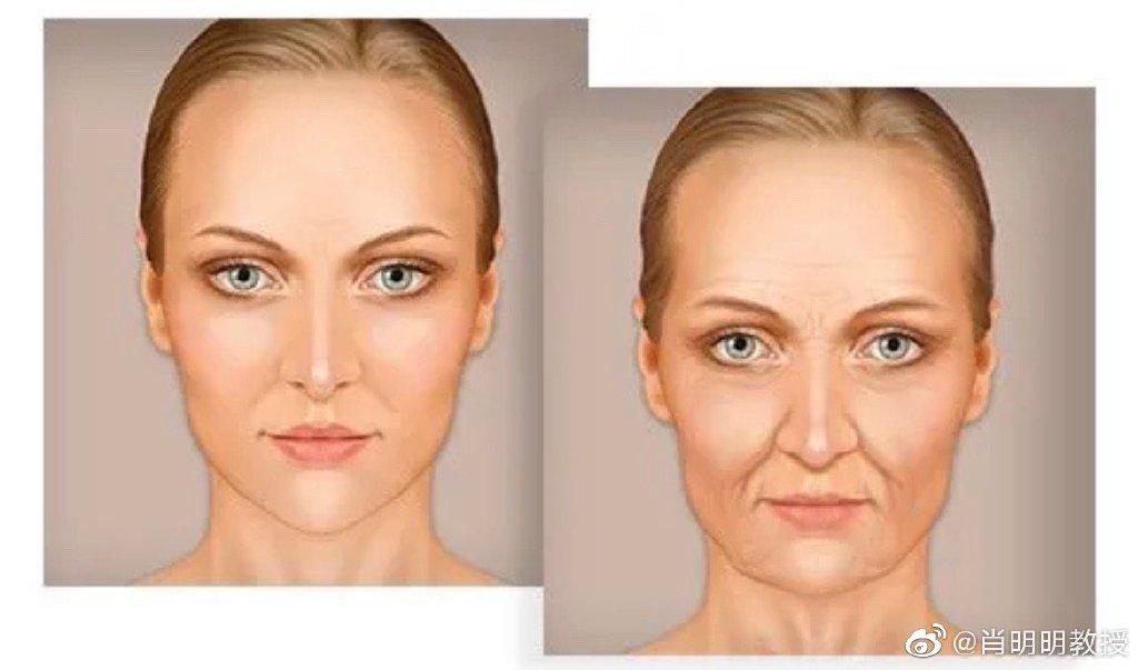 法令纹怎么治疗最快,怎么判断自己的法令纹什么类型