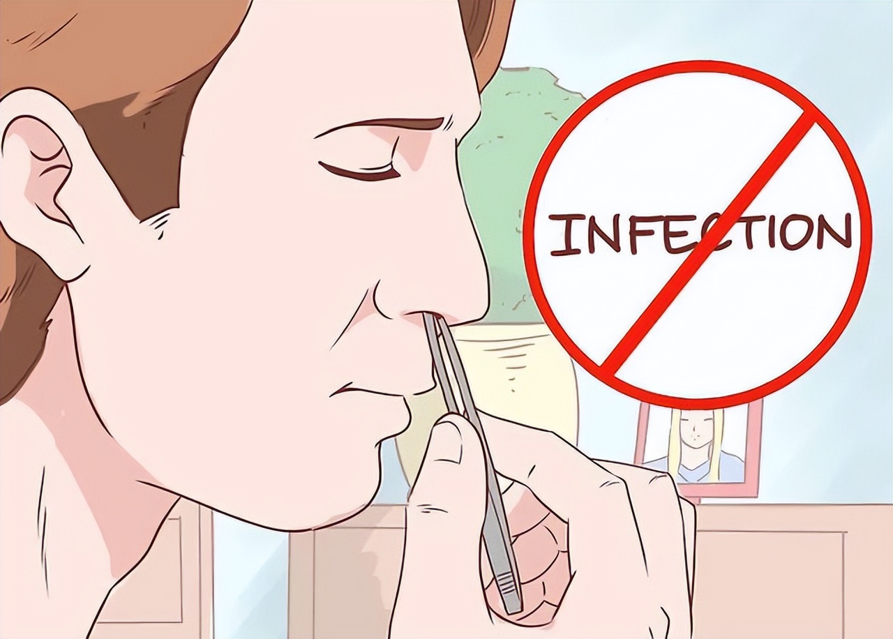 鼻毛总窜出来预示什么,鼻毛总是窜出来怎么解决