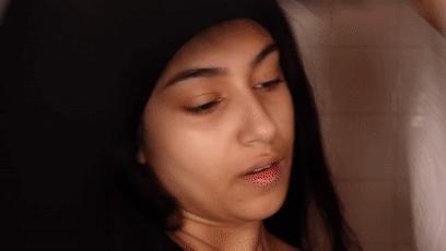 对水过敏的人怎么喝水,怎么会对水过敏