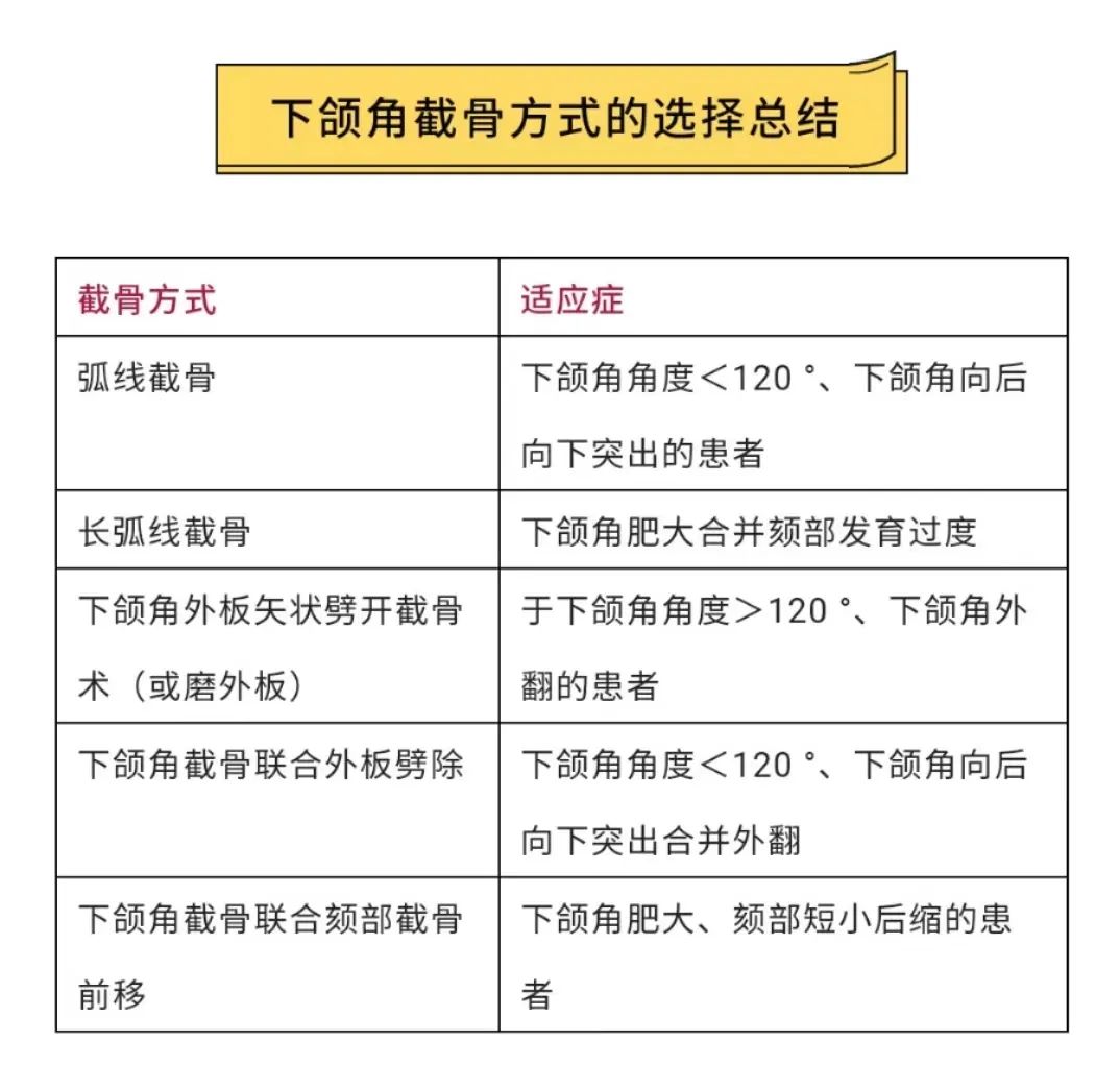 上海九院韦敏轮廓做得好吗,九院韦敏下颌角截骨案