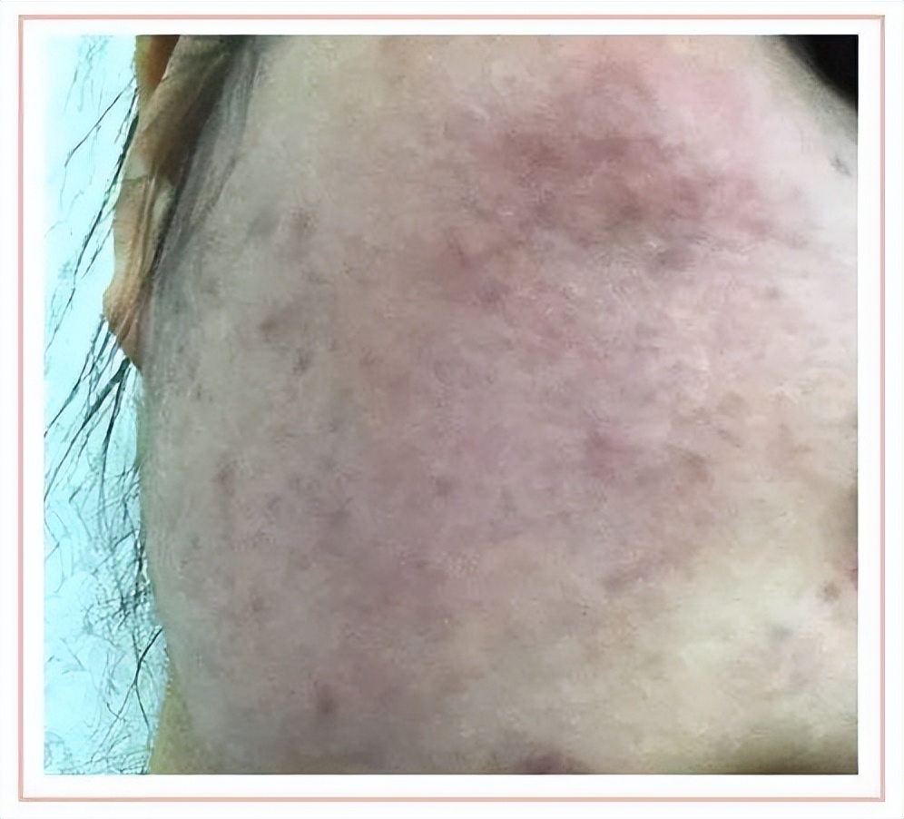 护肤品防腐剂后面的成分可忽略么,护肤品里面的防腐剂有什么用