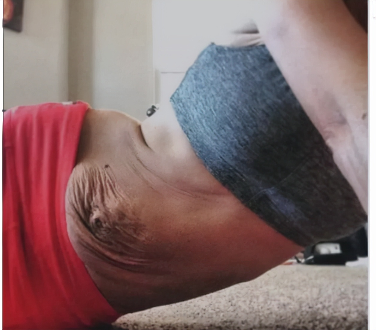 产后腹直肌恢复了肚子还突出,腹直肌分离肚子太松垮