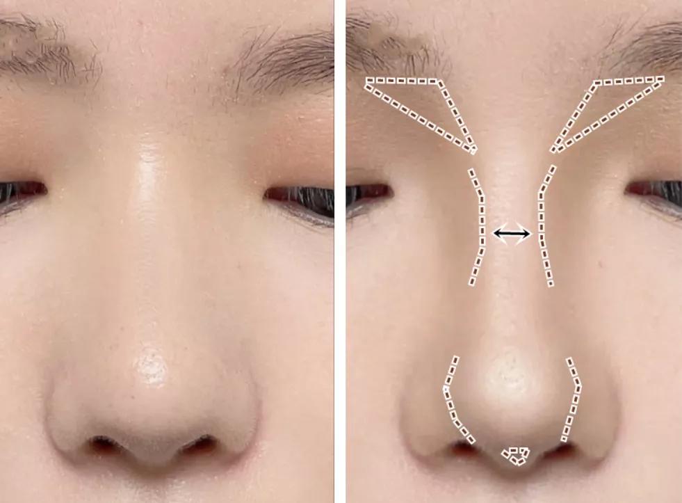 什么是骨相化妆和皮象化妆,皮相和骨相化妆教程一样吗