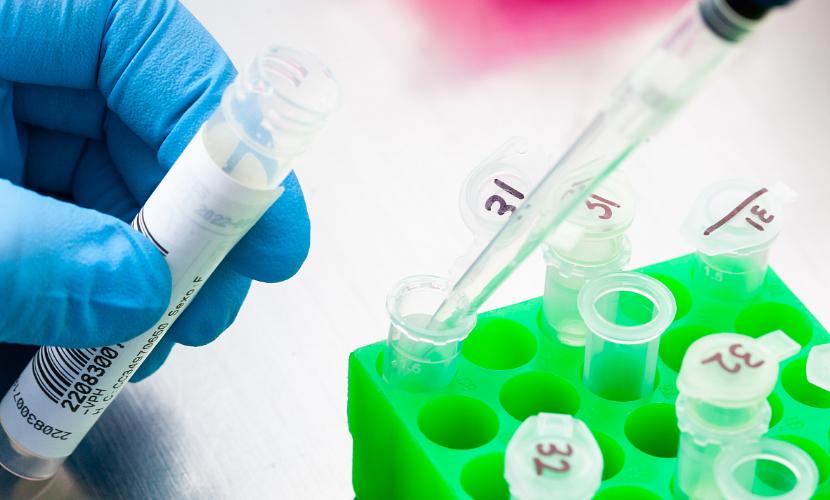 最近流行感冒甲型流感吃什么药,甲型流感症状及治疗法