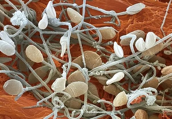 进入女性体内后,没“受精”成功的精子都去哪儿了?既好笑又心疼