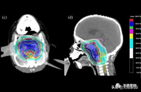 5年生存率超过90%是不是治疗率高,5年生存率图