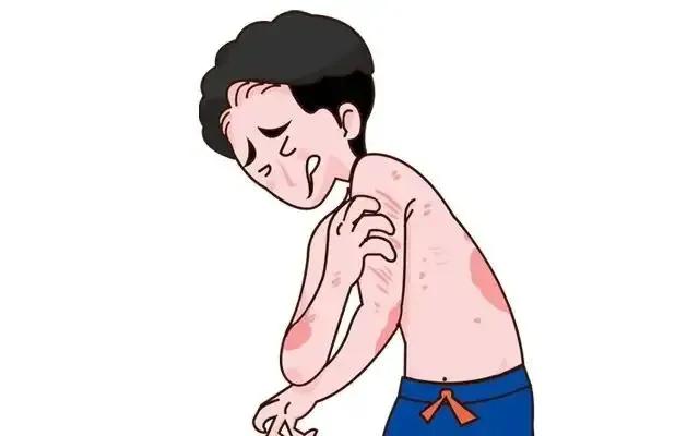 复方青黛丸与银屑灵哪个好,银屑病复方青黛胶囊