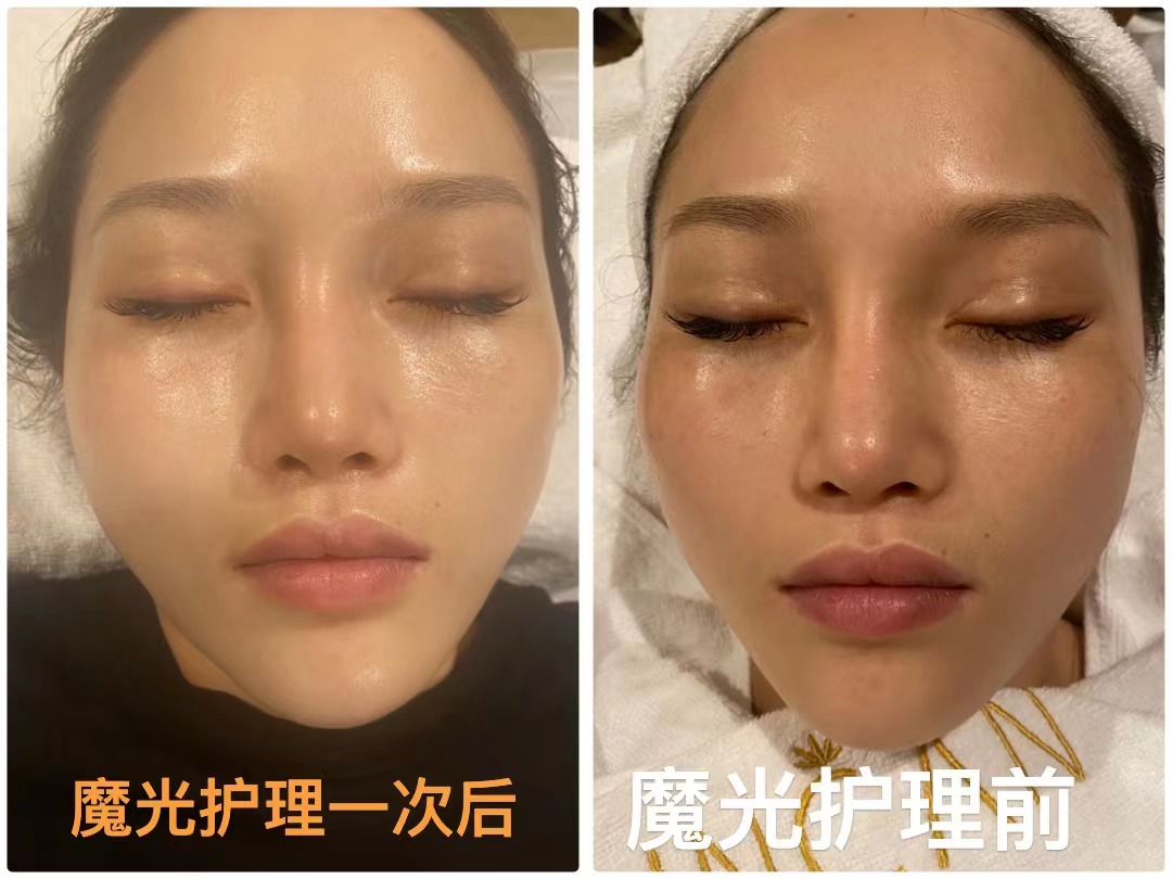 百莲凯美容院项目价格表,百莲凯美容院加盟费多少钱一个月