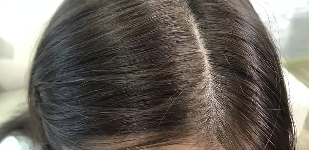 2023阿道夫洗发水真实测评,洗发水排行榜第一名阿道夫