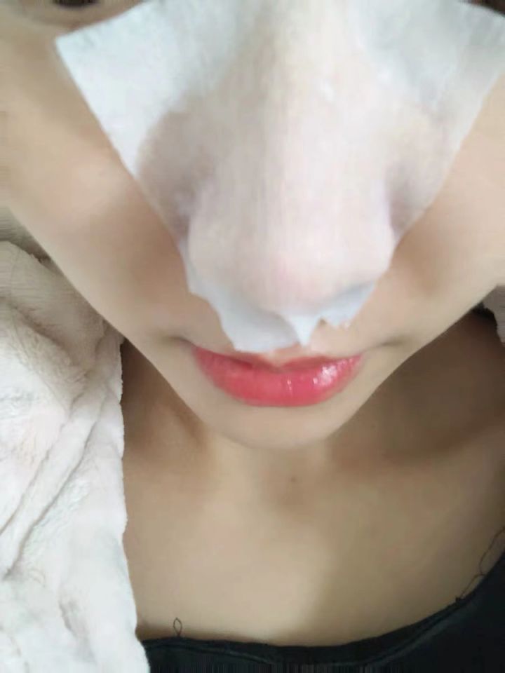 黑头没挤干净怎么办,黑头没及时处理变成黑痣了怎么办