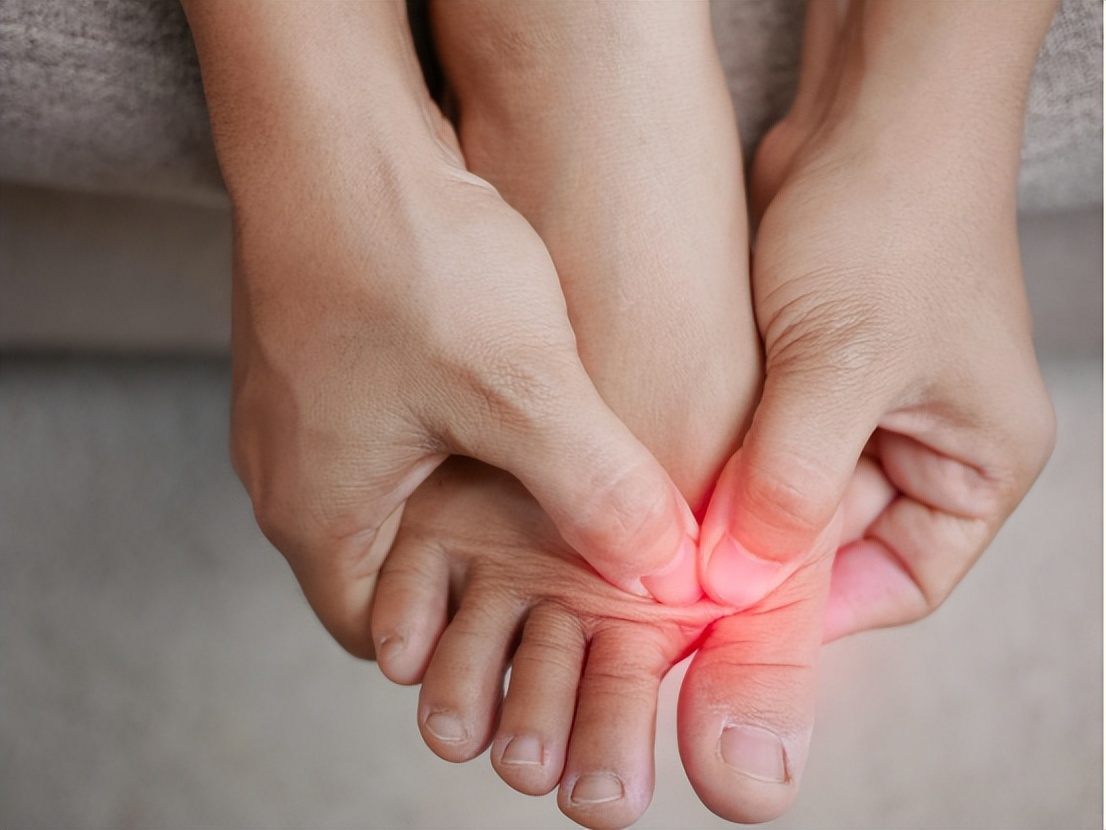 如果尿酸高一般有哪些症状,尿酸高的人若身体出现这3个变化