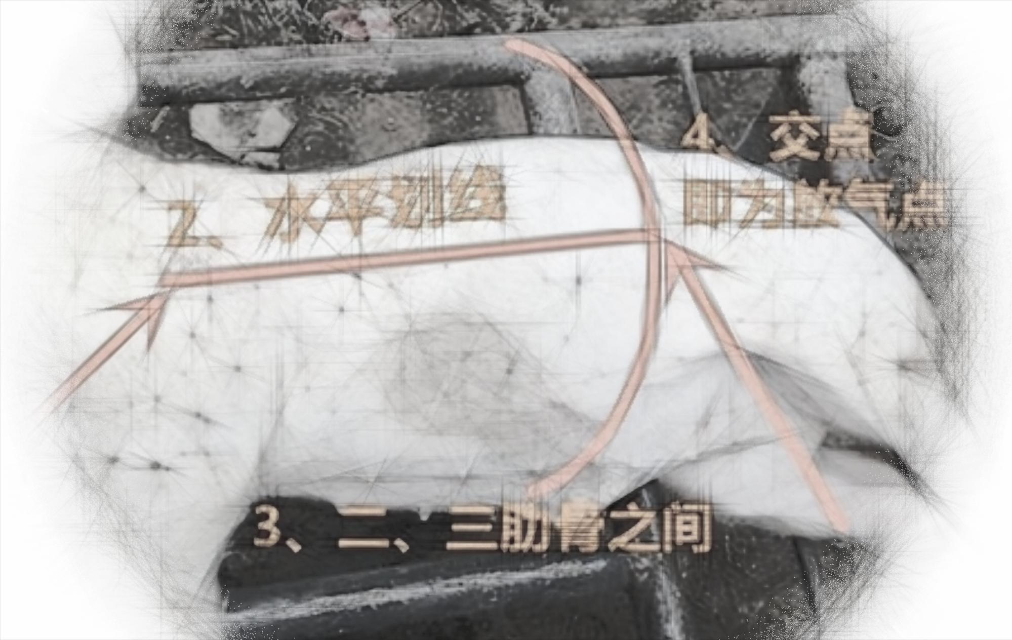 林可霉素淘汰了吗,林可霉素给猪打多了怎么办