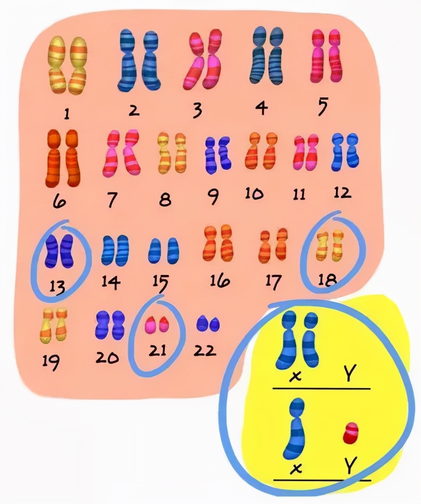 如何正确认识唐筛,唐筛第一项