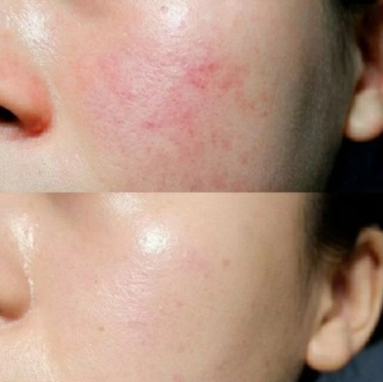 孕期水乳推荐红榜第一名,孕期专用水乳测评