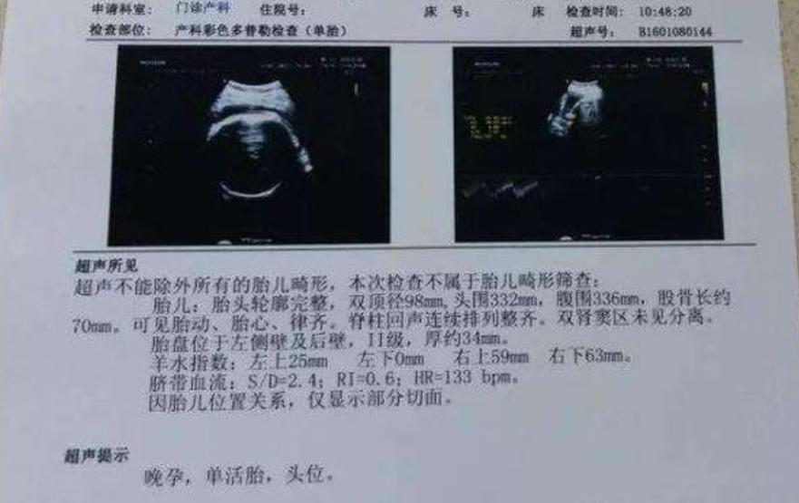 2年没有复查肠镜会得肠癌吗,2年没做检查会得宫颈癌吗