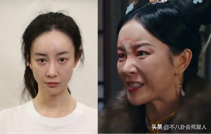 整容脸在现实中的样子,整容最好的脸有多好看