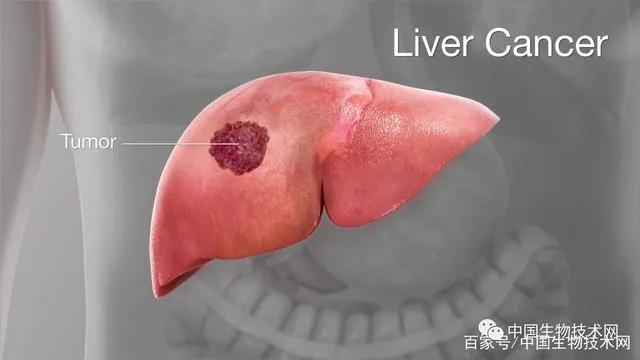 科学家肝癌能治愈吗,科学家何时能彻底治愈肿瘤