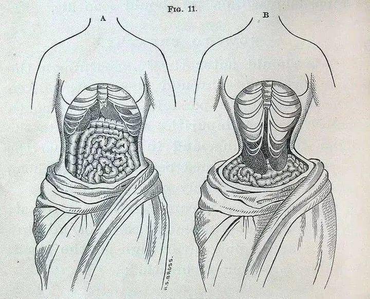 瘦到脸部凹陷到底好不好看,瘦到五官凹陷