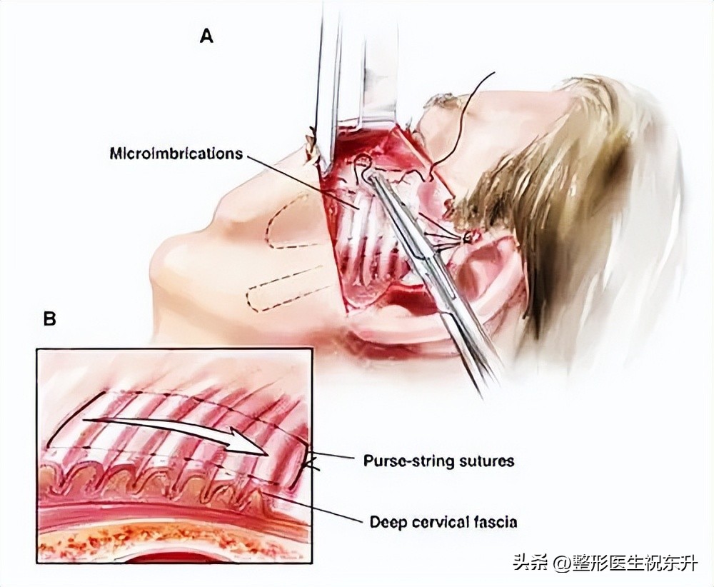 自己在家做拉皮为什么做不好,在家做拉皮的方法全过程