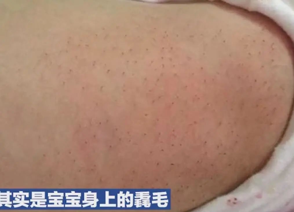 妈妈信偏方害弟弟,妈妈信偏方致宝宝生病