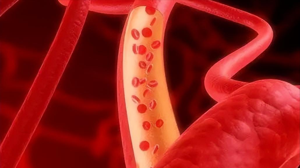 注意性缺陷多动障碍临床表现,注意功能障碍属于什么障碍