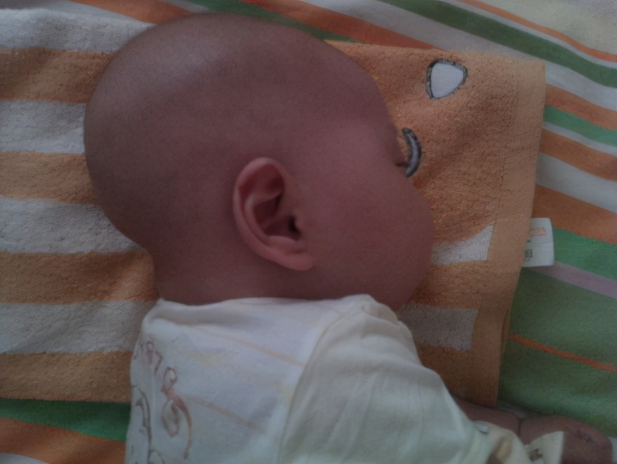 怎么让宝宝的头型睡正有什么方法,宝宝头型两边高低不一样怎么睡