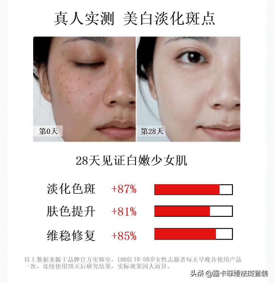 目前最好最有效的祛斑产品,目前最有效的祛斑产品是什么