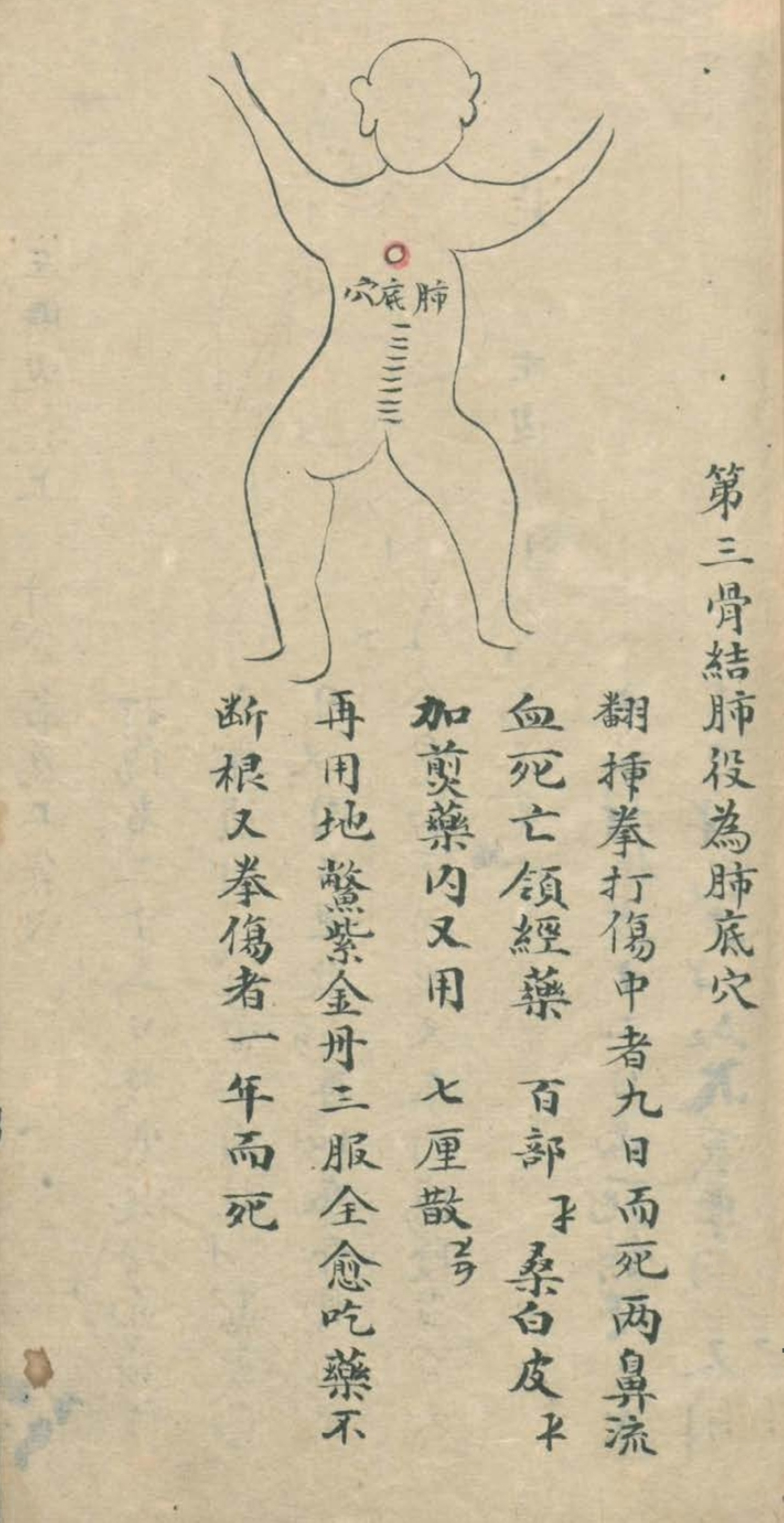 最实用的跌打药方,祖传跌打秘方100首