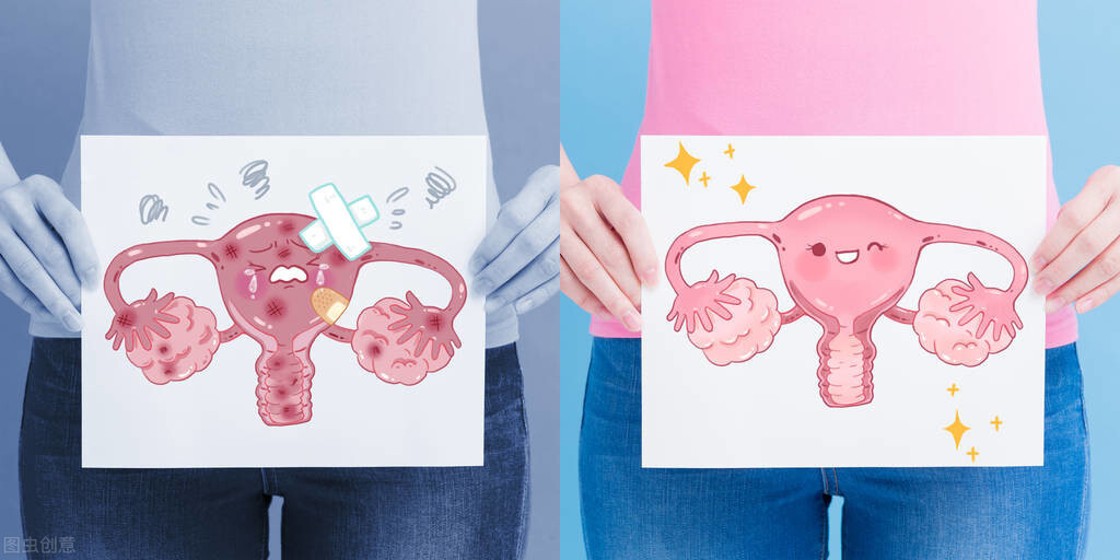 治疗巧克力囊肿最好的大夫,有效治疗巧克力囊肿的医生