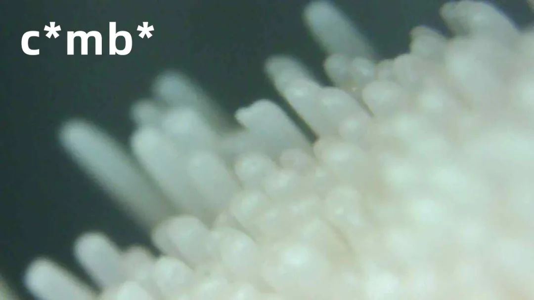 儿童声波全自动电动牙刷测评,显微镜下看牙刷