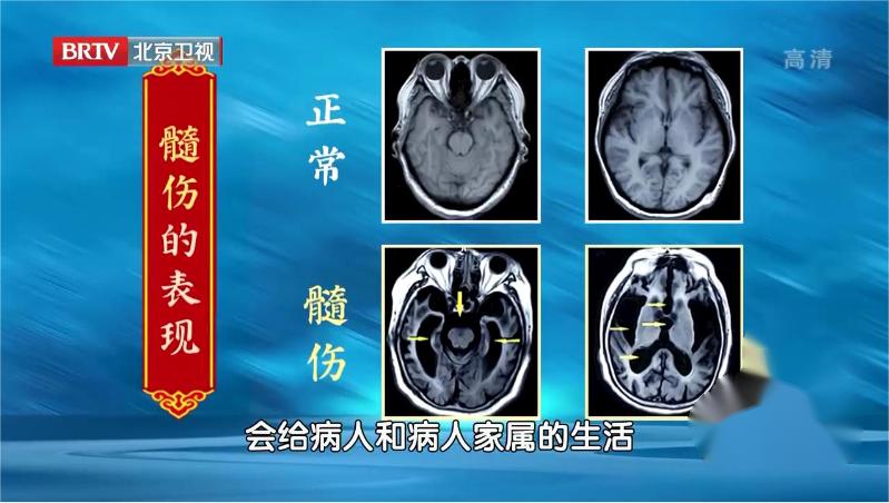 40岁以后每天喝一碗健脑又益智,健脑补肾益精填髓