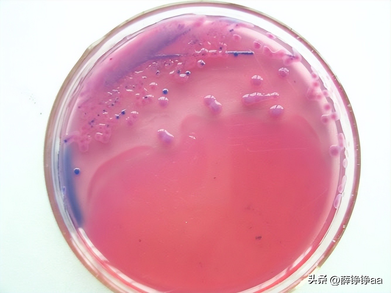 怎样辨别细菌肠胃炎,拉曼光谱法在药品检测中的应用