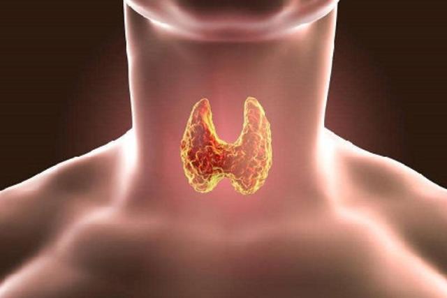 fnh局灶性结节增生有什么忌口的,甲状腺结节和乳腺结节有什么忌口