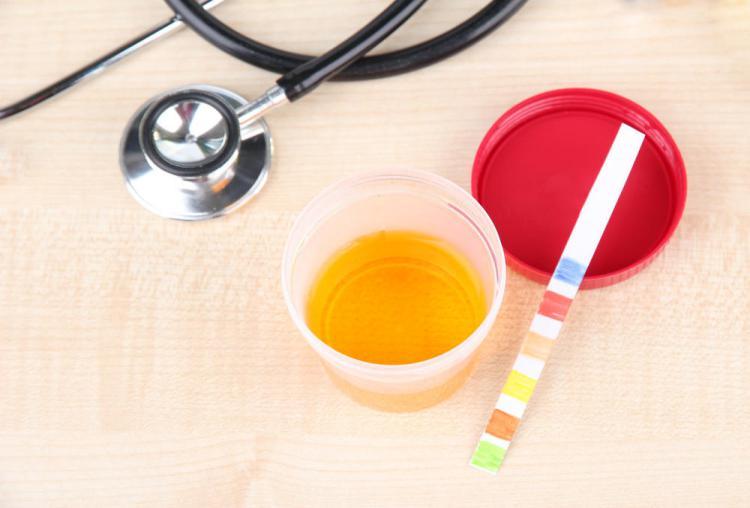 子宫内膜癌现在一直流血,子宫内膜增厚流血是癌吗