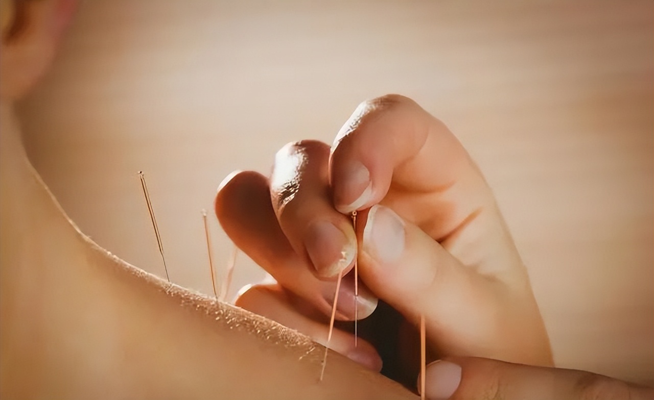 腱鞘囊肿针灸治疗操作方法,腱鞘囊肿可以用银针刺爆吗