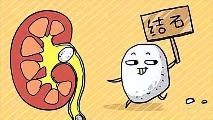 输尿管结石的饮食禁忌事项介绍,胆囊结石微创手术后饮食禁忌