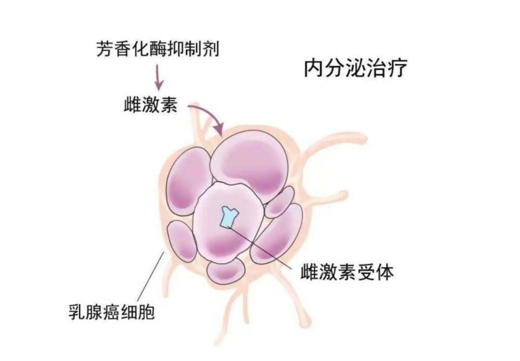 乳腺癌内分泌药有哪些不良反应,乳腺癌内分泌治疗副作用怎么缓解