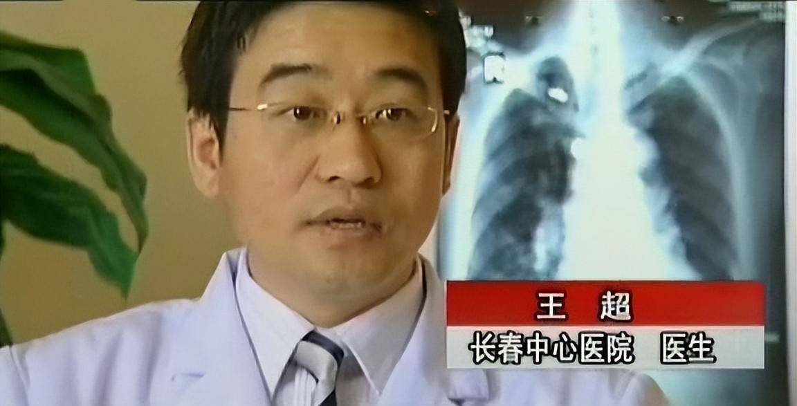 09年吉林一医生频繁听到患者发出猫叫,调查后大惊:染色体出了问题