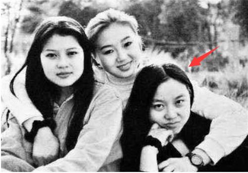 女子割双眼皮失败像瞪眼,女明星割双眼皮对比照