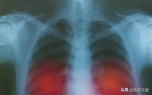 这七大肿瘤筛查方法请牢记，以防被不良体检中心忽悠！