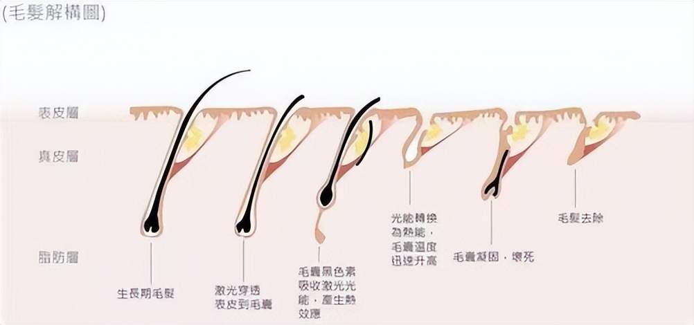 市面上卖的脱毛仪真的有效吗,花那么多买个脱毛仪到底值不值